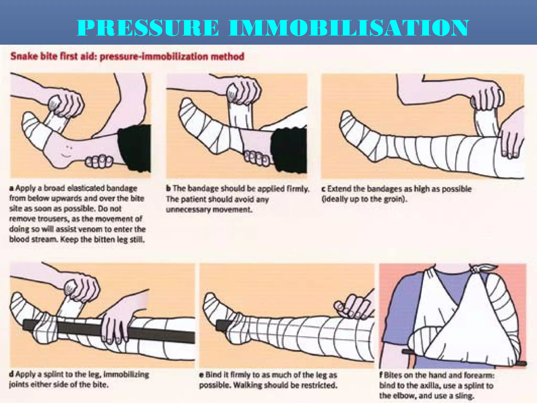 PRESSURE IMMOBILISATION
       METHOD.
 