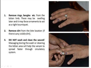 Snake bite First Aid