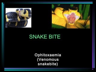 SNAKE BITE
Ophitoxaemia
(Venomous
snakebite)
 