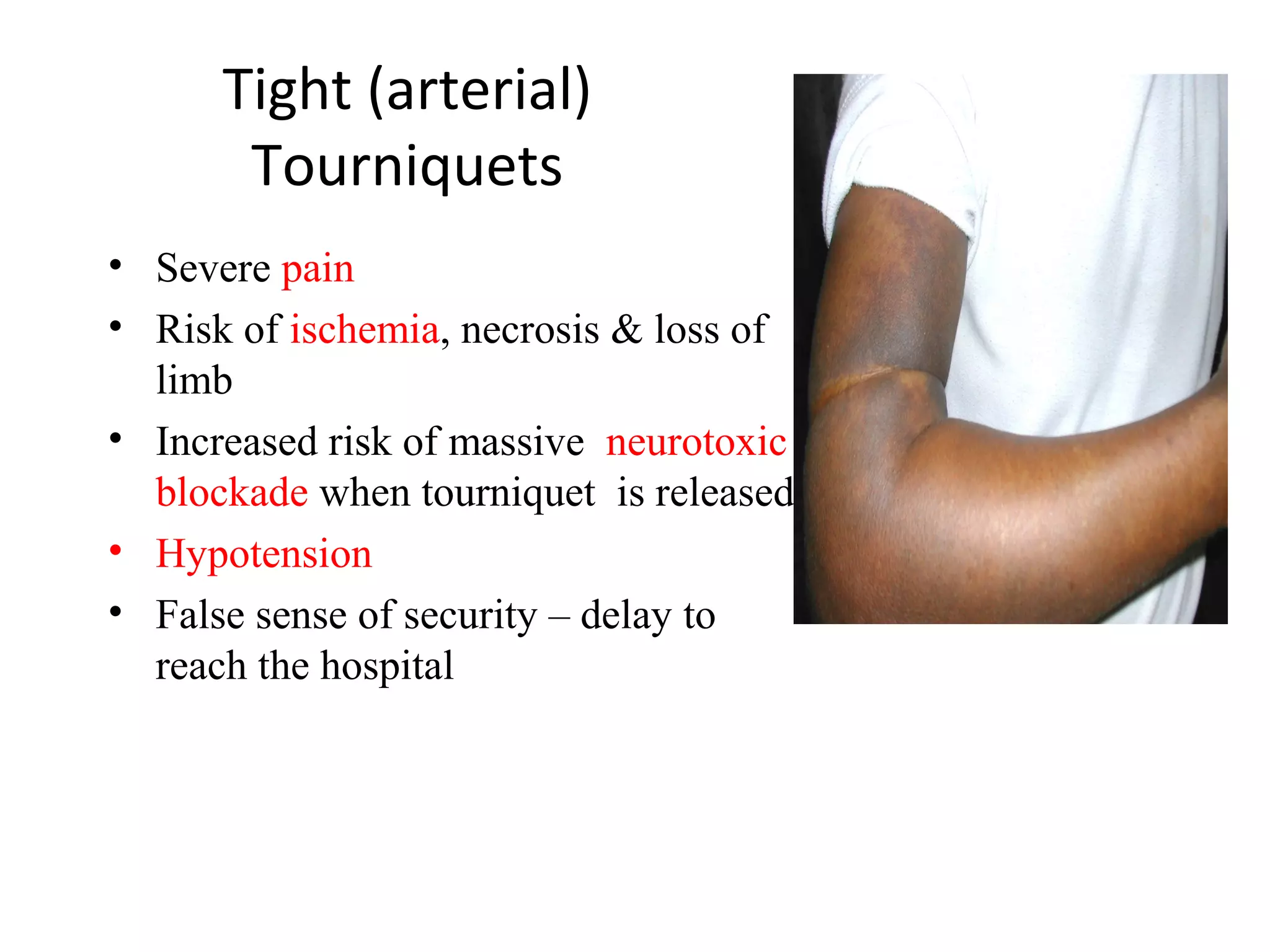 Tight (arterial)
Tourniquets
• Severe pain
• Risk of ischemia, necrosis & loss of
limb
• Increased risk of massive neurotoxic
blockade when tourniquet is released
• Hypotension
• False sense of security – delay to
reach the hospital
 