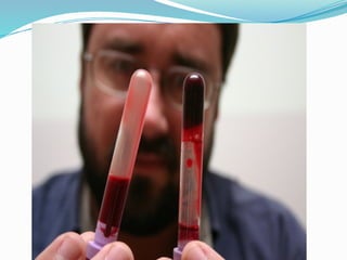 snake bite, Detection,first aid and treatment | PPTX