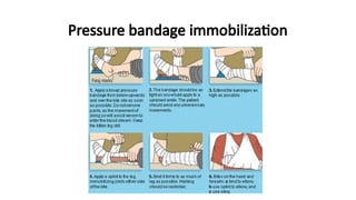 Pressure bandage immobilization
 