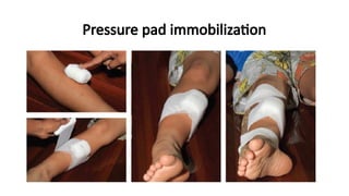 Pressure pad immobilization
 