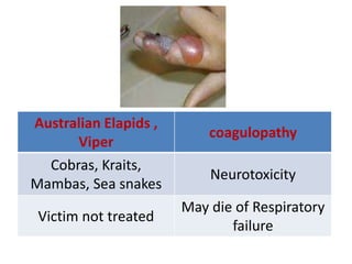 Australian Elapids ,
Viper
coagulopathy
Cobras, Kraits,
Mambas, Sea snakes
Neurotoxicity
Victim not treated
May die of Respiratory
failure
 