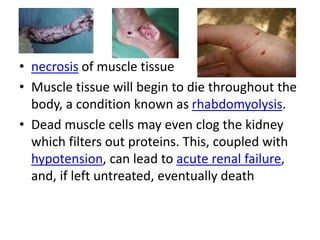 • necrosis of muscle tissue
• Muscle tissue will begin to die throughout the
body, a condition known as rhabdomyolysis.
• Dead muscle cells may even clog the kidney
which filters out proteins. This, coupled with
hypotension, can lead to acute renal failure,
and, if left untreated, eventually death
 