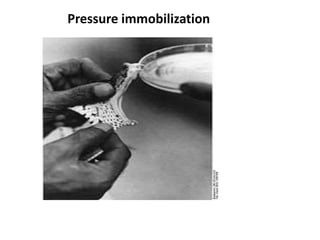 Pressure immobilization
 