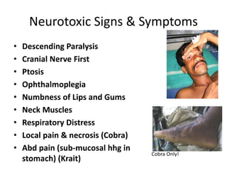 Neurotoxic Signs & Symptoms
• Descending Paralysis
• Cranial Nerve First
• Ptosis
• Ophthalmoplegia
• Numbness of Lips and Gums
• Neck Muscles
• Respiratory Distress
• Local pain & necrosis (Cobra)
• Abd pain (sub-mucosal hhg in
stomach) (Krait)
Cobra Only!
 