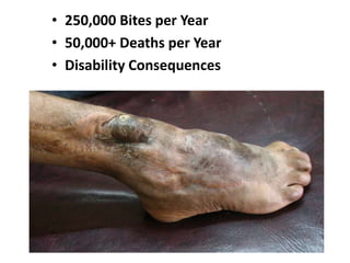 • 250,000 Bites per Year
• 50,000+ Deaths per Year
• Disability Consequences
 