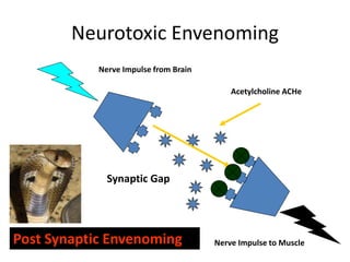 Neurotoxic Envenoming
Acetylcholine ACHe
Nerve Impulse from Brain
Nerve Impulse to Muscle
Synaptic Gap
Post Synaptic Envenoming
 
