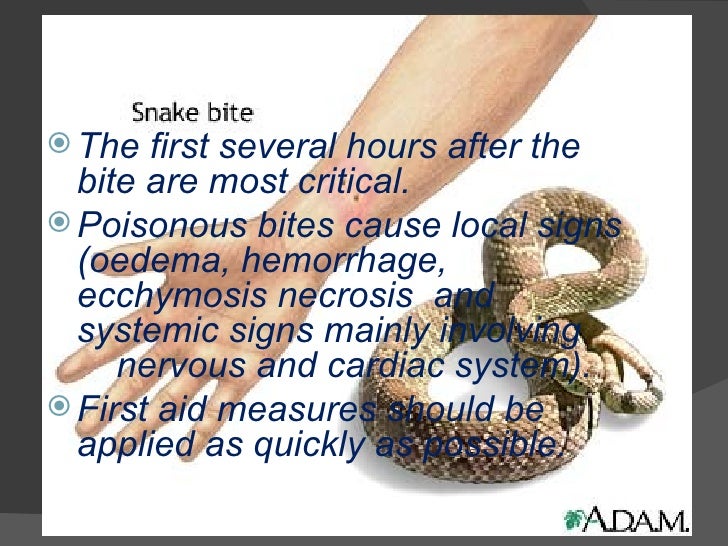 First Aid Of Snake Bite Ppt The Y Guide