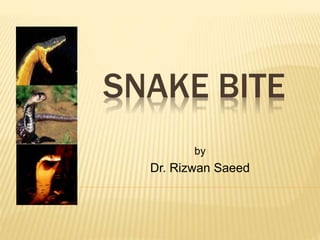 SNAKE BITE
by
Dr. Rizwan Saeed
 