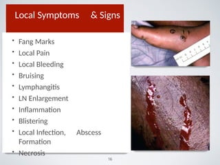 Local Symptoms & Signs
• Fang Marks
• Local Pain
• Local Bleeding
• Bruising
• Lymphangitis
• LN Enlargement
• Inﬂammation
• Blistering
• Local Infection, Abscess
Formation
• Necrosis
16
 