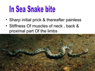 • Sharp initial prick & thereafter painless
• Stiffness Of muscles of neck , back &
  proximal part Of the limbs
 