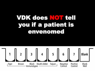 VDK does NOT tell
you if a patient is
   envenomed
 