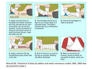 Warrell DA. Treatment of bites by adders and exotic venomous snakes. BMJ. 2005 Nov
26;331(7527):1244-7.
 