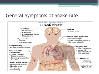 General Symptoms of Snake Bite
 