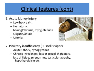 Clinical features (cont)
6. Acute kidney injury
– Low back pain
– Hematuria,
hemoglobinuria, myoglobinuria
– Oliguria/anuria
– Uremia
7. Pituitary insufficiency (Russell’s viper)
– Acute : shock, hypoglycemia
– Chronic : weakness, loss of sexual characters,
loss of libido, amenorrhea, testicular atrophy,
hypothyroidism etc
 