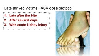 Late arrived victims : ASV dose protocol
1. Late after the bite
2. After several days
3. With acute kidney injury
 