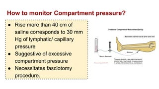 How to monitor Compartment pressure?
● Rise more than 40 cm of
saline corresponds to 30 mm
Hg of lymphatic/ capillary
pressure
● Suggestive of excessive
compartment pressure
● Necessitates fasciotomy
procedure.
 