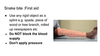 Snake bite :First aid
● Use any rigid object as a
splint e.g. spade, piece of
wood or tree branch, rolled
up newspapers etc
● Do NOT block the blood
supply
● Don't apply pressure
 