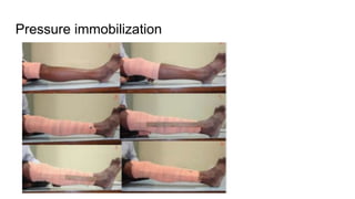 Pressure immobilization
 
