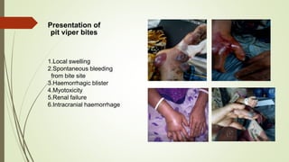 Presentation of
pit viper bites
1.Local swelling
2.Spontaneous bleeding
from bite site
3.Haemorrhagic blister
4.Myotoxicity
5.Renal failure
6.Intracranial haemorrhage
 