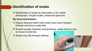  Identification of snake by description or by model,
photograph, brought snake, preserved specimen.
By local examination-
 Classic fang and teeth mark rarely occur and if present
indicate venomous snake bite
 Scratch usually indicates nonvenomous snake bite but may
be found in krait bite
 Snake may bite through clothing
Identification of snake
 