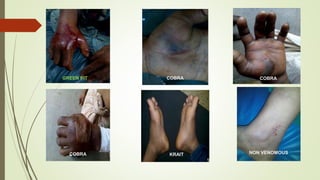 GREEN PIT COBRA COBRA
COBRA KRAIT NON VENOMOUS
 