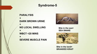 Syndrome-5
PARALYSIS
+
DARK BROWN URINE
+
NO LOCAL SWELLING
+
WBCT <20 MINS
+
SEVERE MUSCLE PAIN
Bite in the sea=
SEA SNAKE
Bite in the land=
BRANDED KRAIT
 