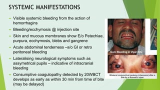 SYSTEMIC MANIFESTATIONS
 Visible systemic bleeding from the action of
hemorrhagins
 Bleeding/ecchymosis @ injection site
 Skin and mucous membranes show E/o Petechiae,
purpura, ecchymosis, blebs and gangrene
 Acute abdominal tenderness –s/o GI or retro
peritoneal bleeding
 Lateralising neurological symptoms such as
assymetrical pupils – indicative of intracranial
bleeding
 Consumptive coagulopathy detected by 20WBCT
develops as early as within 30 min from time of bite
(may be delayed)
 