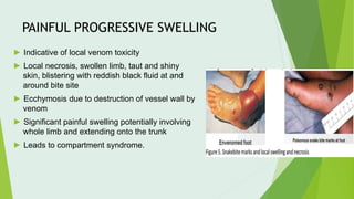 PAINFUL PROGRESSIVE SWELLING
► Indicative of local venom toxicity
► Local necrosis, swollen limb, taut and shiny
skin, blistering with reddish black fluid at and
around bite site
► Ecchymosis due to destruction of vessel wall by
venom
► Significant painful swelling potentially involving
whole limb and extending onto the trunk
► Leads to compartment syndrome.
 