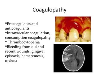 Coagulopathy

Procoagulants and
anticoagulants
Intravascular coagulation,
consumption coagulopahty
 Thrombocytopenia
Bleeding from old and
recent wounds, gingiva,
epistaxis, hematemesis,
melena
 