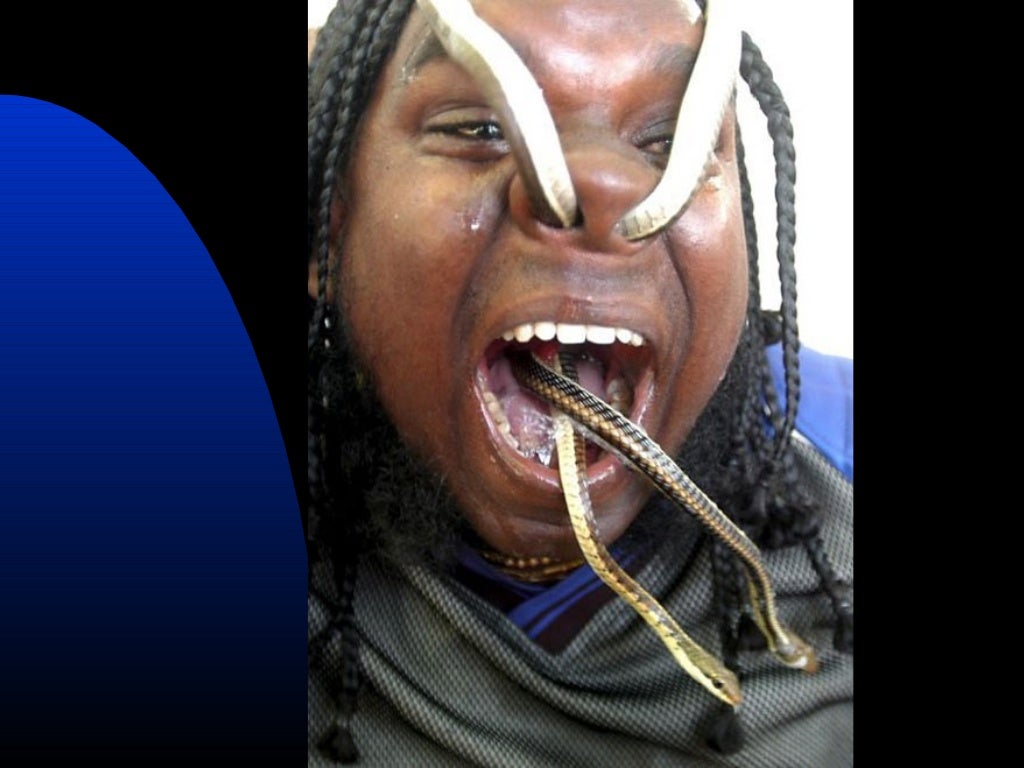 Snake bites