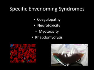 Specific Envenoming Syndromes
• Coagulopathy
• Neurotoxicity
• Myotoxicity
• Rhabdomyolysis
 