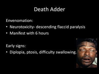Death Adder
Envenomation:
• Neurotoxicity- descending flaccid paralysis
• Manifest with 6 hours
Early signs:
• Diplopia, ptosis, difficulty swallowing.
 