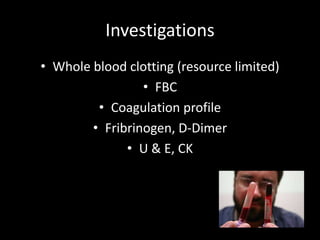 Investigations
• Whole blood clotting (resource limited)
• FBC
• Coagulation profile
• Fribrinogen, D-Dimer
• U & E, CK
 