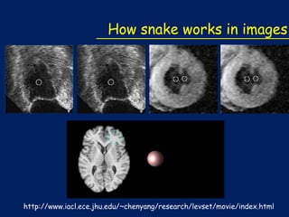 How snake works in images

http://www.iacl.ece.jhu.edu/~chenyang/research/levset/movie/index.html

 