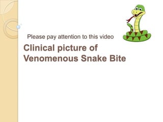 Clinical picture of
Venomenous Snake Bite
Please pay attention to this video
 