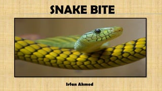 SNAKE BITE
Irfan Ahmed
 