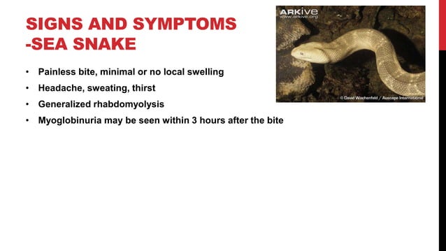 Snake & Snake bites | PPTX | First Aid | Injuries