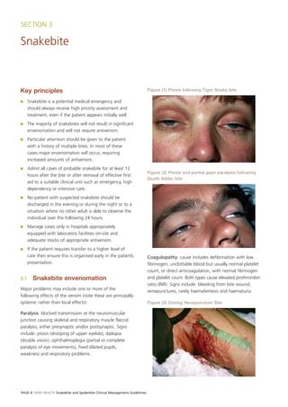 SECTION 3

Snakebite



Key principles                                                              Figure (1) Ptosis following Tiger Snake bite

■     Snakebite is a potential medical emergency and
      should always receive high priority assessment and
      treatment, even if the patient appears initially well.
■     The majority of snakebites will not result in significant
      envenomation and will not require antivenom.
■     Particular attention should be given to the patient
      with a history of multiple bites. In most of these
      cases major envenomation will occur, requiring
      increased amounts of antivenom.
■     Admit all cases of probable snakebite for at least 12
                                                                            Figure (2) Ptosis and partial gaze paralysis following
      hours after the bite or after removal of effective first
                                                                            Death Adder bite
      aid to a suitable clinical unit such as emergency, high
      dependency or intensive care.
■     No patient with suspected snakebite should be
      discharged in the evening or during the night or to a
      situation where no other adult is able to observe the
      individual over the following 24 hours.
■     Manage cases only in hospitals appropriately
      equipped with laboratory facilities on-site and
      adequate stocks of appropriate antivenom.
■     If the patient requires transfer to a higher level of
      care then ensure this is organised early in the patients              Coagulopathy: cause includes defibrination with low
      presentation.                                                         fibrinogen, unclottable blood but usually normal platelet
                                                                            count, or direct anticoagulation, with normal fibrinogen
3.1     Snakebite envenomation                                              and platelet count. Both types cause elevated prothrombin
                                                                            ratio (INR). Signs include: bleeding from bite wound,
Major problems may include one or more of the                               venepunctures, rarely haematemesis and haematuria.
following effects of the venom (note these are principally
systemic rather than local effects):                                        Figure (3) Oozing Venepuncture Site

Paralysis: blocked transmission at the neuromuscular
junction causing skeletal and respiratory muscle flaccid
paralysis, either presynaptic and/or postsynaptic. Signs
include: ptosis (drooping of upper eyelids), diplopia
(double vision), ophthalmoplegia (partial or complete
paralysis of eye movements), fixed dilated pupils,
weakness and respiratory problems.




PAGE 8 NSW HEALTH Snakebite and Spiderbite Clinical Management Guidelines
 
