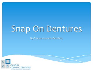 Snap On Dentures
By Cancun Cosmetic Dentistry

 