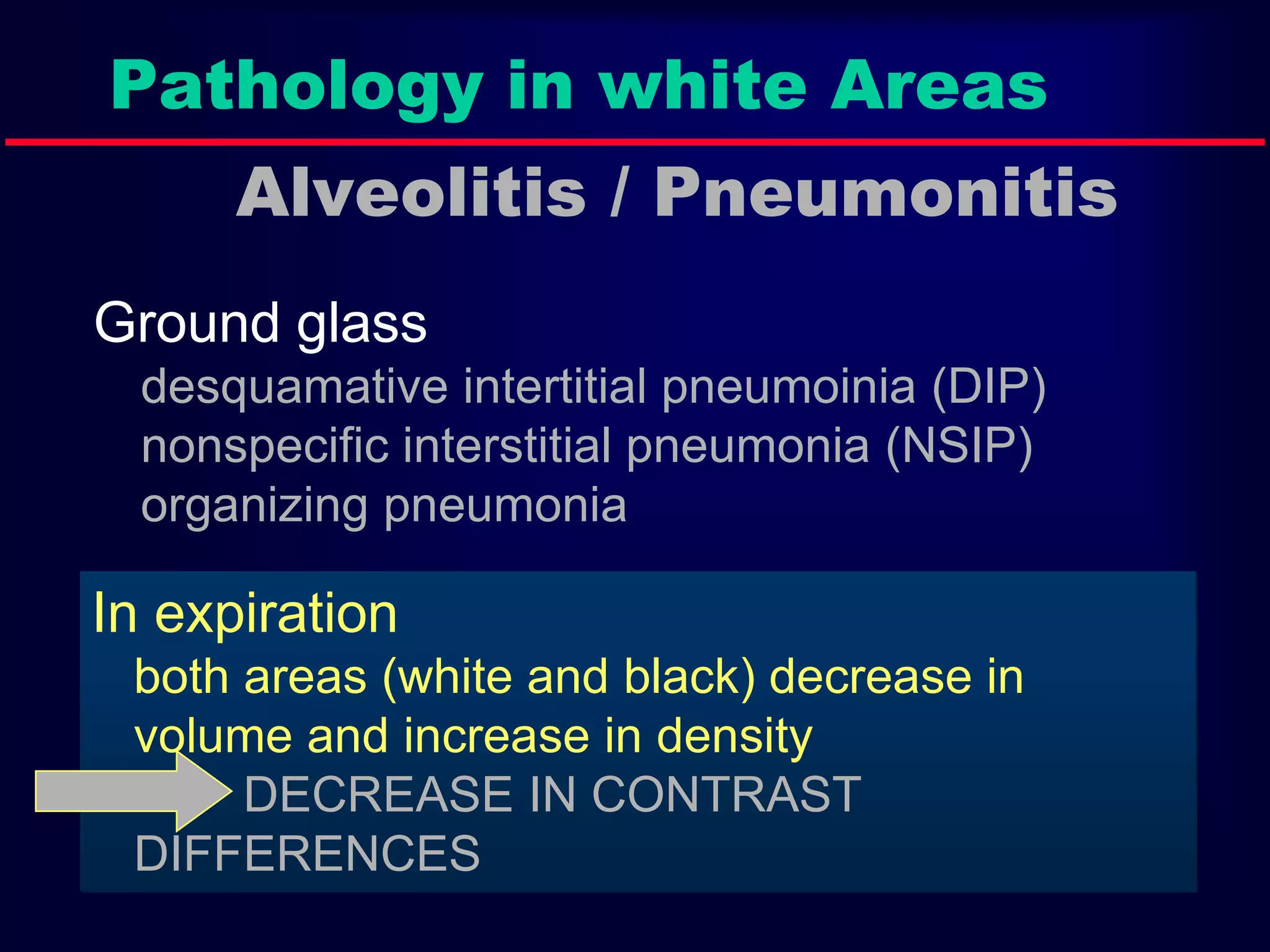 Pathology in white Areas
Alveolitis / Pneumonitis
Ground glass
desquamative intertitial pneumoinia (DIP)
nonspecific interstitial pneumonia (NSIP)
organizing pneumonia
In expiration
both areas (white and black) decrease in
volume and increase in density
DECREASE IN CONTRAST
DIFFERENCES
 