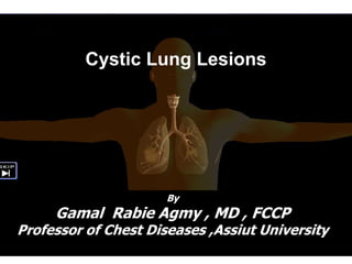 Cystic Lung Lesions
By
Gamal Rabie Agmy , MD , FCCP
Professor of Chest Diseases ,Assiut University
 