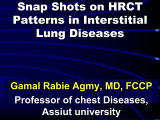Snap Shots on HRCT
Patterns in Interstitial
Lung Diseases
Gamal Rabie Agmy, MD, FCCP
Professor of chest Diseases,
Assiut university
 