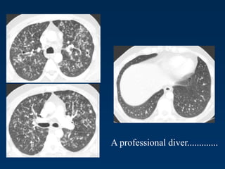 A professional diver.............
 
