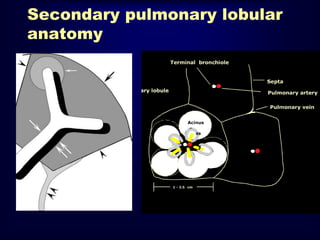 Secondary pulmonary lobular
anatomy
 
