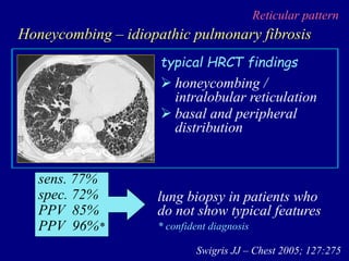  honeycombing /
intralobular reticulation
 basal and peripheral
distribution
typical HRCT findings
sens. 77%
spec. 72%
PPV 85%
PPV 96%*
Swigris JJ – Chest 2005; 127:275
lung biopsy in patients who
do not show typical features
Reticular pattern
Honeycombing – idiopathic pulmonary fibrosis
* confident diagnosis
 
