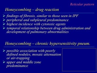 Reticular pattern
Honeycombing – drug reaction
 findings of fibrosis, similar to those seen in IPF
 peripheral and subpleural predominance
 highest incidence with cytotoxic agents
 temporal relationship between drug administration and
development of pulmonary abnormalities
Honeycombing – chronic hypersensitivity pneum.
 possible association with poorly
defined nodules, mosaic attenuation
or air-trapping
 upper and middle zone
predominance
 