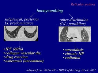 Reticular pattern
adapted from: Webb RW – HRCT of the lung, III ed; 2001
honeycombing
•IPF (60%)
•collagen vascular dis.
•drug reaction
•asbestosis (uncommon)
subpleural, posterior
LL predominance
•sarcoidosis
•chronic HP
•radiation
other distribution
(UL; parahilar)
 